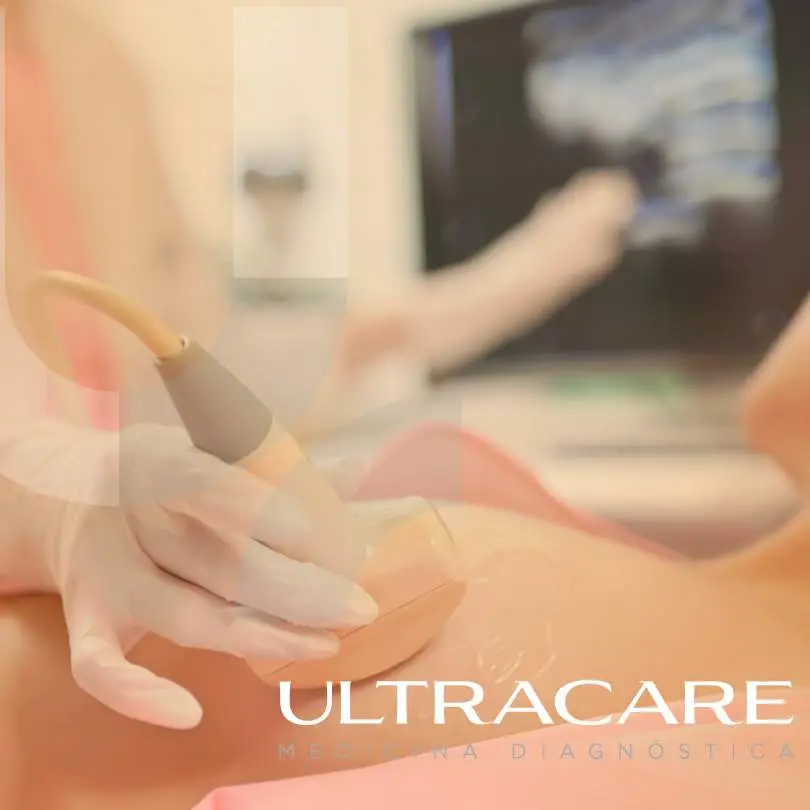 exames por imagem, ultrassom, ultrassonografia, ULTRACARE, ultrassom abdominal, Obstétrico, transvaginal, mama, ecocardiograma, doppler